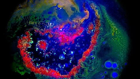 The modular nanoparticles consist of biodegradable polymer cores coated with genetically modified cell membranes.
(Representational image: Wikimedia Commons)