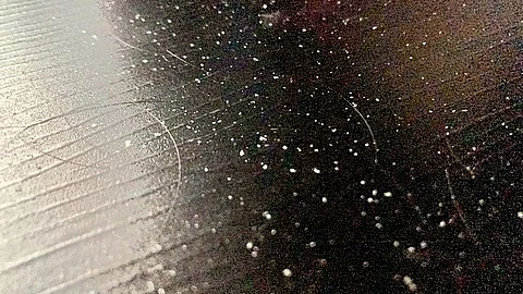 Dandruff, a common scalp condition, affects people of all ages, especially in the cold winter months. (Representational Iamge: Wikimedia Commons)