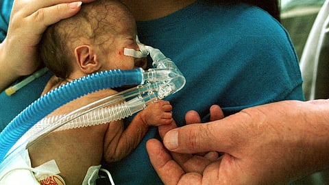 In response to a high oxygen insult, the lungs of wild-type mice (left-hand side) show alveolar simplification and enlargement, septal wall thickening (blue arrow), and leukocyte infiltration (black arrows), all features seen in human disease(Representational image :Wikimedia commons)