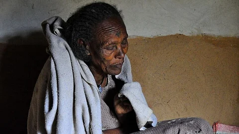 Huntington’s disease causes involuntary movements and dementia, has no cure, and is fatal (representational image: Wikimedia Commons).