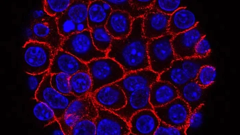 The study, published in JAMA Network Open, found that nearly half of high-risk prostate cancer patients previously classified as nonmetastatic by conventional imaging actually have metastatic disease. (Representational image: Unsplash)