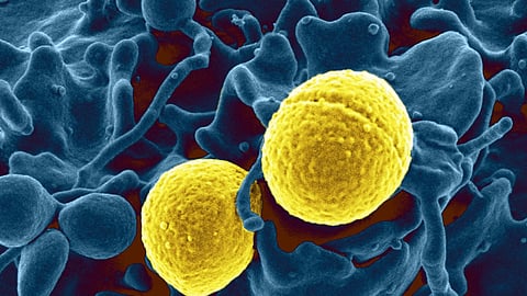 Researchers at Monash University in Australia have cracked the code behind IKAROS, an essential protein for immune cell development and protection against pathogens and cancer (Representational image : Wikimedia commons)