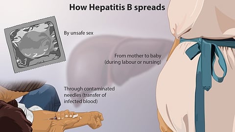 Hepatitis B is a viral infection that attacks the liver and can cause both acute and chronic disease. It is most commonly transmitted from mother to child during birth and delivery in early childhood. (Wikimedia Commons)