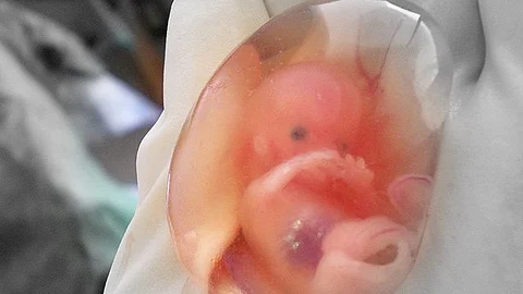 With a blood sample from the expectant mother, they can scrutinize all the genes in the fetus. (Representational Image: Wikimedia Commons)