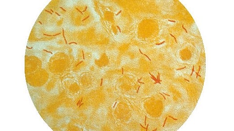 The research has been published in the article ‘Discovery of dual-active ethionamide boosters inhibiting the Mycobacterium tuberculosis ESX-1 secretion system’ in Cell Chemical Biology.(Representational Image: CDC Phil)