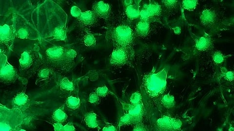 Aspergillus fumigatus relies on a delicate balance in regulating gliotoxin production to prevent excess and mitigate toxicity to the fungus itself.(Representational Image: Wikimedia Commons)