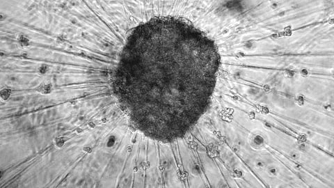 Mouse dorsal root ganglion neurons (Representational Image: Wikimedia Commons)