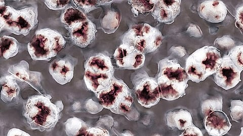 NANOGEL - SCHEME OF SELECTIVE DRUG TREATMENT IN THE CENTRAL NERVOUS SYSTEM (Representational image: Wikimedia commons)