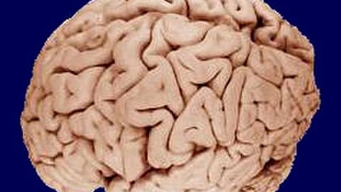 A new study in fruit flies reveals how the brain’s internal compass and steering regions work together. (Representational Image: Wikimedia Commons)