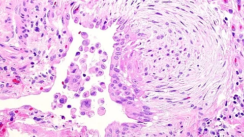 Fibroblasts are the most abundant cells in the penis of both mice and humans, but they have been neglected in research. (Representational Image: Wikimedia Commons)