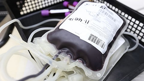 The two blood banks, whose licenses were terminated on Monday, were named Srikara Hospital Blood Centre and New Life Educational Society Blood Centre. (Representational Image: Pixabay)