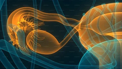 Most cases of ovarian cancer are diagnosed at more advanced stages, when the disease has already spread throughout the body. (Representational image: Unsplash)