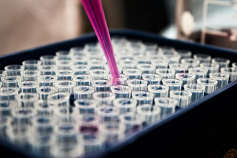 The Indian government has pledged to achieve countrywide elimination of Hepatitis C by 2030. (Representational Image: Unsplash)