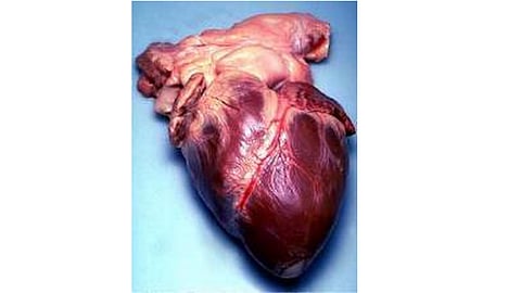 Physicians in the Smidt Heart Institute at Cedars-Sinai have pioneered using a catheter-based approach to treat patients with tricuspid valve disease. (Representational Image: Wikimedia  Commons)