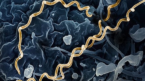 Surge in Syphilis Cases Leads Some Providers to Ration Penicillin (Representational image: Wikimedia Commons)