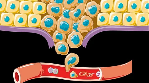 Proliferation of cancer cells (Wikimedia Commons)