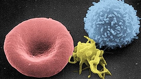 For years, there has been a long-held belief that acute viral infections like Zika or COVID-19 are directly responsible for neurological damage. (Representational Image: Wikimedia Commons)