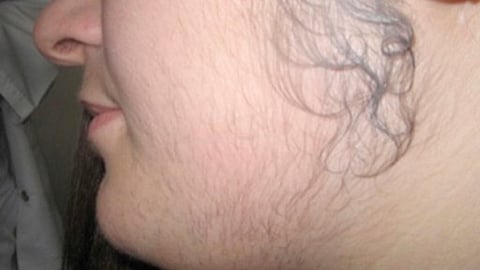For some people, that may mean having a little more peach fuzz on their cheeks than their friends, but for others, it could mean a handful of thick chin hair. (Representational Image: Wikimedia Commons)