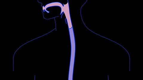 Eosinophilic esophagitis (EoE) is an allergic inflammatory disorder that affects the esophagus (Representational image: Wikimedia Commons)