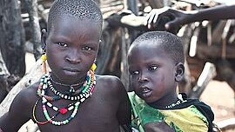 Children suffering from this illness undergo societal ostracism and stigma. (Representational image: Wikimedia commons)