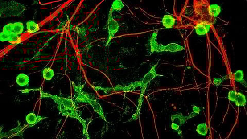 Disease-associated microglia/macrophages are thought to be protective, as they participate in removing lipid-rich waste derived from tissue damage. (Representational Image: Wikimedia Commons)