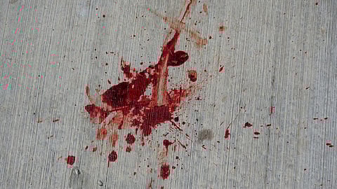 On Thursday, a paramedic’s bloodied body was found by the roadside, triggering protests at the college. (Representational Image: Unsplash)