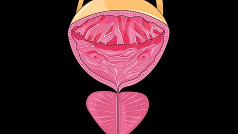 The Phase 3 CELLEBRATE trial to test a regenerative stem cell-based therapy in treating patients with stress urinary incontinence (Representational Image: Wikimedia Commons)