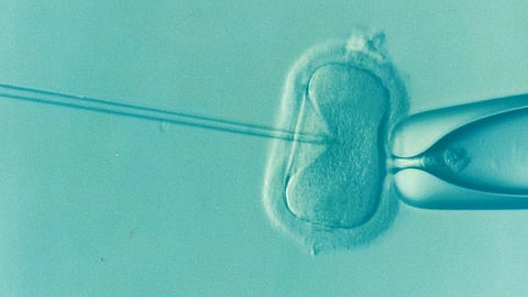 The circumstance is in connection with the IVF treatment of murdered Punjabi singer Sidhu Moosewala's mother. (Representational Image: Pixabay)