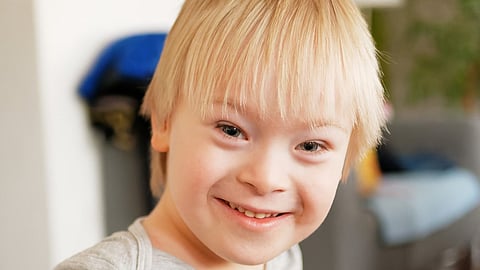 Around 3,000 to 5,000 births of children are born with Down Syndrome annually. (Unsplash)