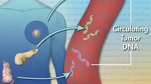 The Guardant's Shield test detects colorectal cancer signals in the blood from DNA that is shed by tumors, which is called circulating tumor DNA (ctDNA). (Representational Image: Wikimedia Commons)
