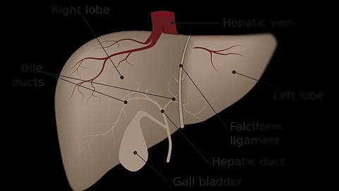An estimated 25% of the world’s population has metabolic dysfunction-associated steatotic liver disease(MASLD)
(Representational Image: Wikimedia Commons)