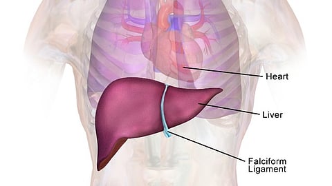 Resmetirom is a first-of-its-kind medication for treating metabolic dysfunction-associated steatohepatitis (MASH), a more advanced stage of  metabolic dysfunction-associated steatotic liver disease (MASLD). (Representational Image: Wikimedia Commons)