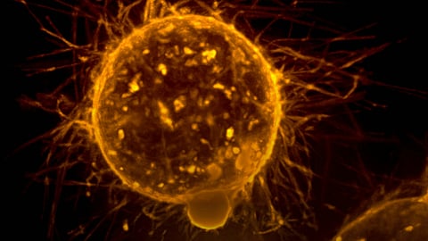 Combining the KRAS G12C inhibitor adagrasib with the anti-EGFR antibody cetuximab demonstrated promising anti-tumor effects in patients with KRAS G12C-mutated metastatic colorectal cancer (CRC) (Representational image: Unsplash)