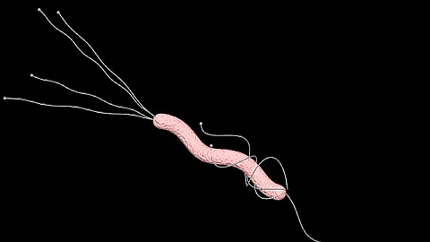 Physician-scientist, Shria Kumar and her colleagues launched a community-based study to test for and treat Helicobacter pylori - a major risk factor for gastric cancer. (Representational Image: Unsplash)