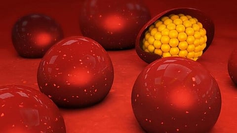 Malaria infected cells (Wikimedia Commons)