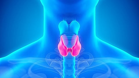 Thyroid gland dysfunction (Representational image: Wikimedia commons)