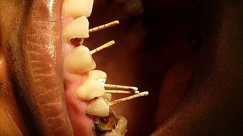 Geriatric dentistry is a specialized field within dentistry focused on delivering dental services tailored to the needs of elderly individuals (Wikimedia Commons)