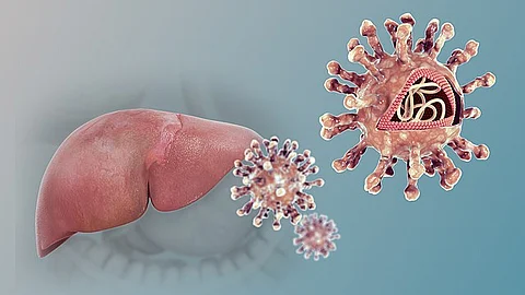 Hepatitis B and C are responsible for the majority of these deaths, with hepatitis B causing 83% and hepatitis C causing 17%. (Representational image: Wikimedia commons)