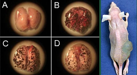 The treatment, composed of nanoparticles fashioned from the cowpea mosaic virus—a virus that infects black-eyed pea plants—showed remarkable success in protecting against a broad range of metastatic cancers (colon, ovarian, melanoma and breast cancer) in mice.