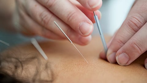 Clean needles save lives, but they might be illegal in some states.(Representational image: Unsplash)