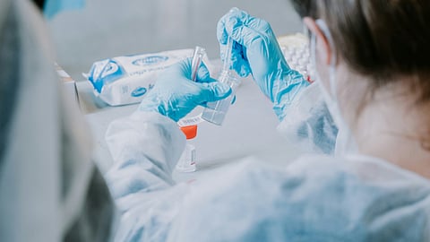 The research team found that donepezil did not improve memory or other cognitive functions in survivors with cancer-related cognitive impairment. (Representational Image: Unsplash)