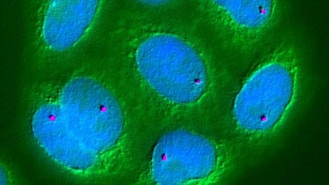Mayo clinic's scientists have found that combination of two compounds dasatinib and quercetin can kill the Zombie cells.