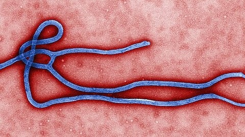 This study, published in Science Direct, aims to enhance understanding of Ebola by reproducing its effects in a controlled laboratory setting.(Representational image: Wikimedia commons)