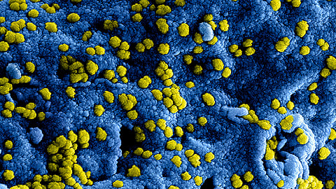 The front-line role of mucus means it is often the site of the first symptoms of infection or disease. (Representational Image: Unsplash)