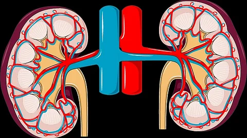 The long-awaited Increasing Organ Transplant Access (IOTA) Model was released on 8 May, 2024 by the Center for Medicare and Medicaid Innovation (CMMI) focusing on increasing patient's access to kidney transplantation across the United States. (Representational image: Wikimedia Commons)