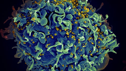 Americans with HIV Are Living Longer, but Federal Funding Is Lagging Behind (Representational image: Unsplash)