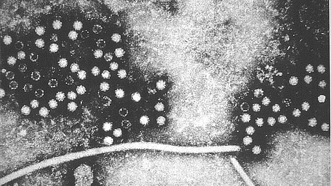 Discovering that hepatitis E virus is associated with sperm in pigs suggests the virus may be both sexually transmitted and linked to male infertility, according to a new study. (Wikimedia Commons)