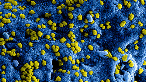 The findings could be used to develop topical or bacterium-based treatments for patients with wounds that do not heal well on their own.
(Representational Image: Unsplash)