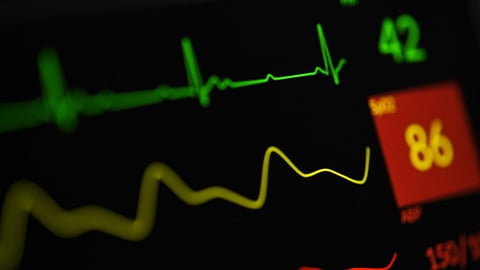 Wearables track various health metrics, including heart rate variability. It can be surprising when your device alerts you to high or low variability, prompting you to pay closer attention to your health. (Representational image: Unsplash)