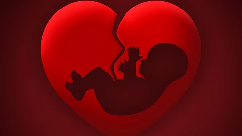 The Amar Hospital in Kalamboli is under the scanner following the death of a 25-year-old woman from Pune who succumbed to an abortion on July 8.
(Pixabay)